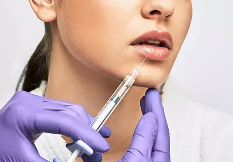 Dermal Fillers